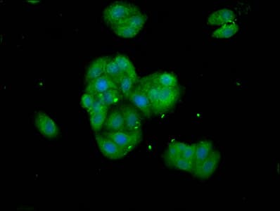 TNKS / Tankyrase Antibody