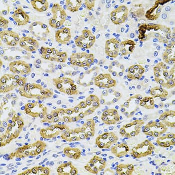 PIK3CA / PI3K Alpha Antibody