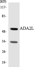 TADA2L / ADA2A Antibody (aa189-238)
