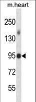 Polyclonal Rabbit anti-Human MLK4 / KIAA1804 Antibody (aa566-593, IHC, WB)