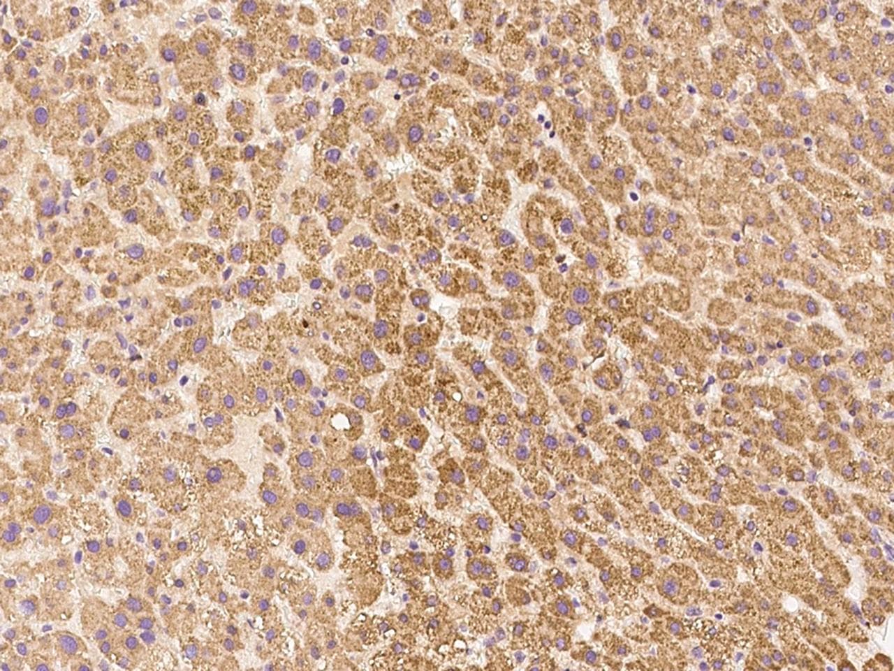 Polyclonal Rabbit anti-Human LIN52 Antibody (IHC)