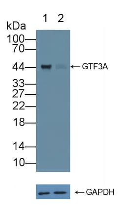 Polyclonal Rabbit anti-Human GTF3A Antibody (WB)