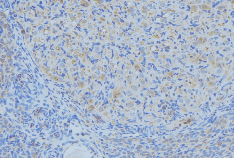 Polyclonal Rabbit anti-Human NGF Antibody (IHC, WB)