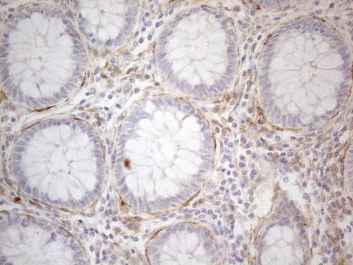 ANPEP / CD13 Antibody (aa668-967, clone OTI3F8, Carrier-free)