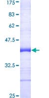 Human TRAF7 Protein (Recombinant GST, N-terminus)