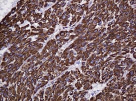 HSPD1 / HSP60 Antibody (clone OTI3G10)