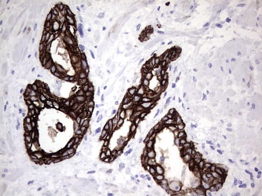 Monoclonal Mouse anti-Human KRT19 / CK19 / Cytokeratin 19 Antibody (clone OTI5H6, aa240-390, IHC, WB)