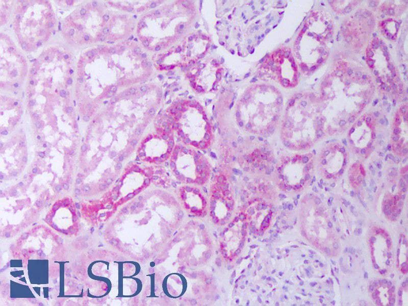 IHC-plus™ IL31 Antibody