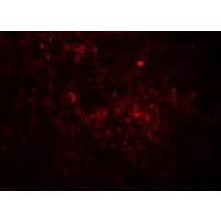 IHC-plus™ JAG1 / Jagged 1 Antibody