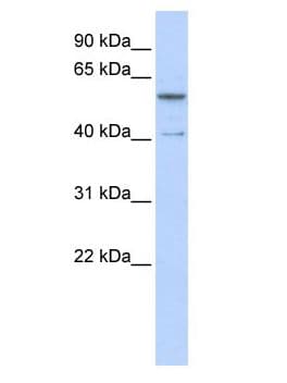 ZNF284 Antibody (aa448-507)