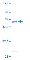 Human YWHAB / 14-3-3 Beta Protein (Recombinant GST)