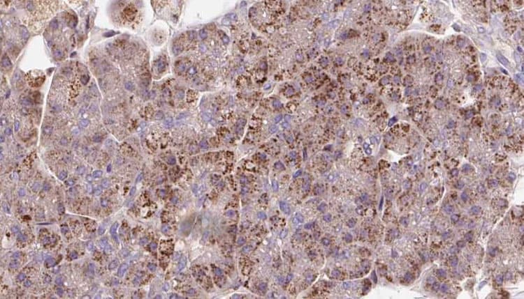 Polyclonal Rabbit anti-Human PDE6A / PDE6 Alpha Antibody (IHC, WB)