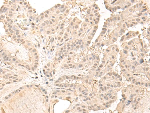 ZGPAT Antibody