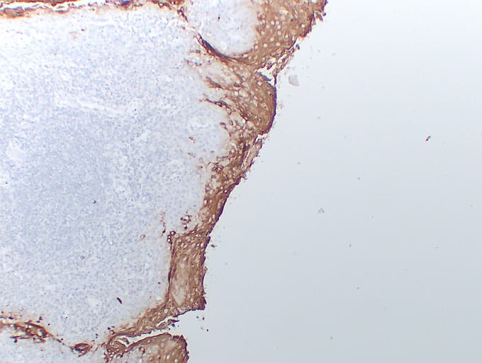 CEACAM5 / CD66e Antibody (clone ABT-CEA)