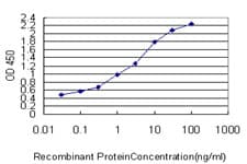 CRTAP Antibody (clone 4D9)