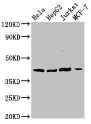 SPPL3 / IMP2 Antibody