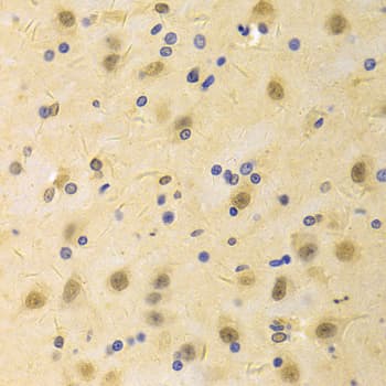 Polyclonal Rabbit anti-Human AICAR / ATIC Antibody (IHC, IF, WB)