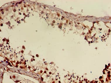 DMRT1 Antibody