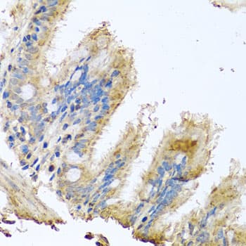 Polyclonal Rabbit anti-Human COXG / COX6B1 Antibody (IHC, WB)