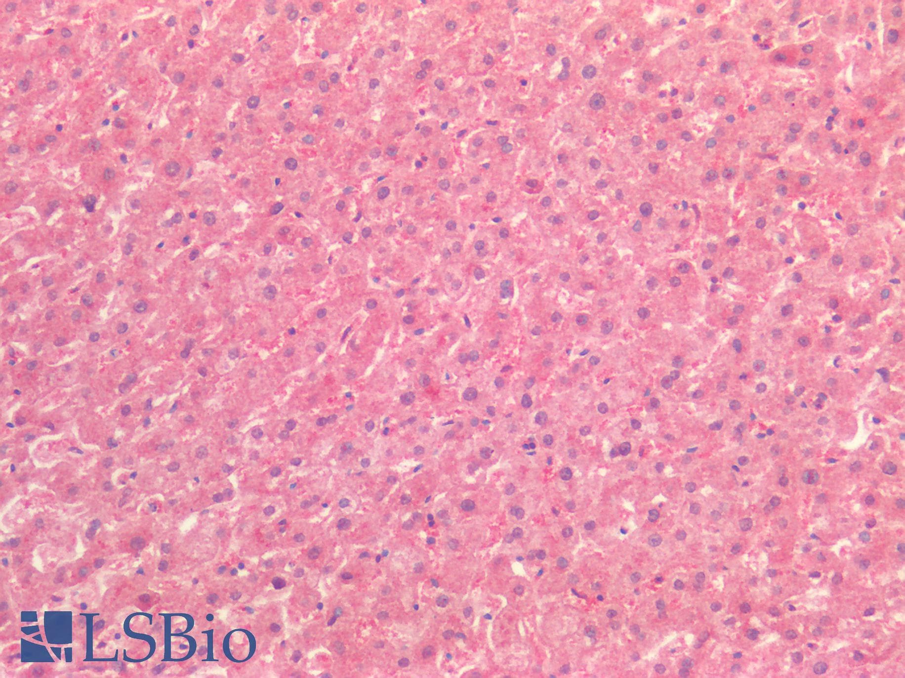PathPlus™ TTR / Transthyretin Antibody