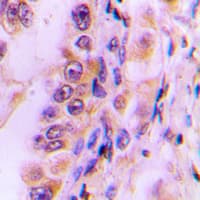 DAP-5 / EIF4G2 Antibody (N-Terminus)