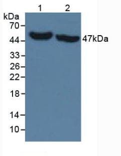 PathPlus™ IDH1 / IDH Antibody (clone C13)