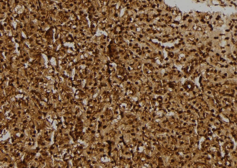 R3HCC1L / C10orf28 Antibody