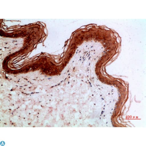 Polyclonal Rabbit anti-Human KRT14 / CK14 / Cytokeratin 14 Antibody (WB)
