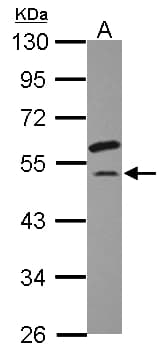EIF2S3 / EIF2G Antibody