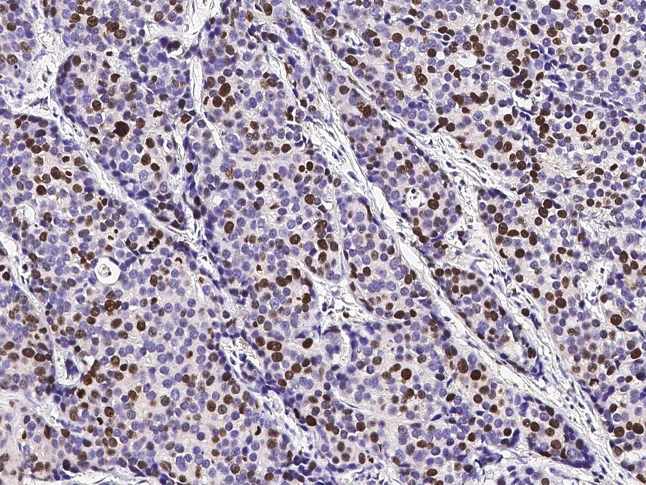 MKI67 / Ki67 Antibody (clone 22, Preservative Free)