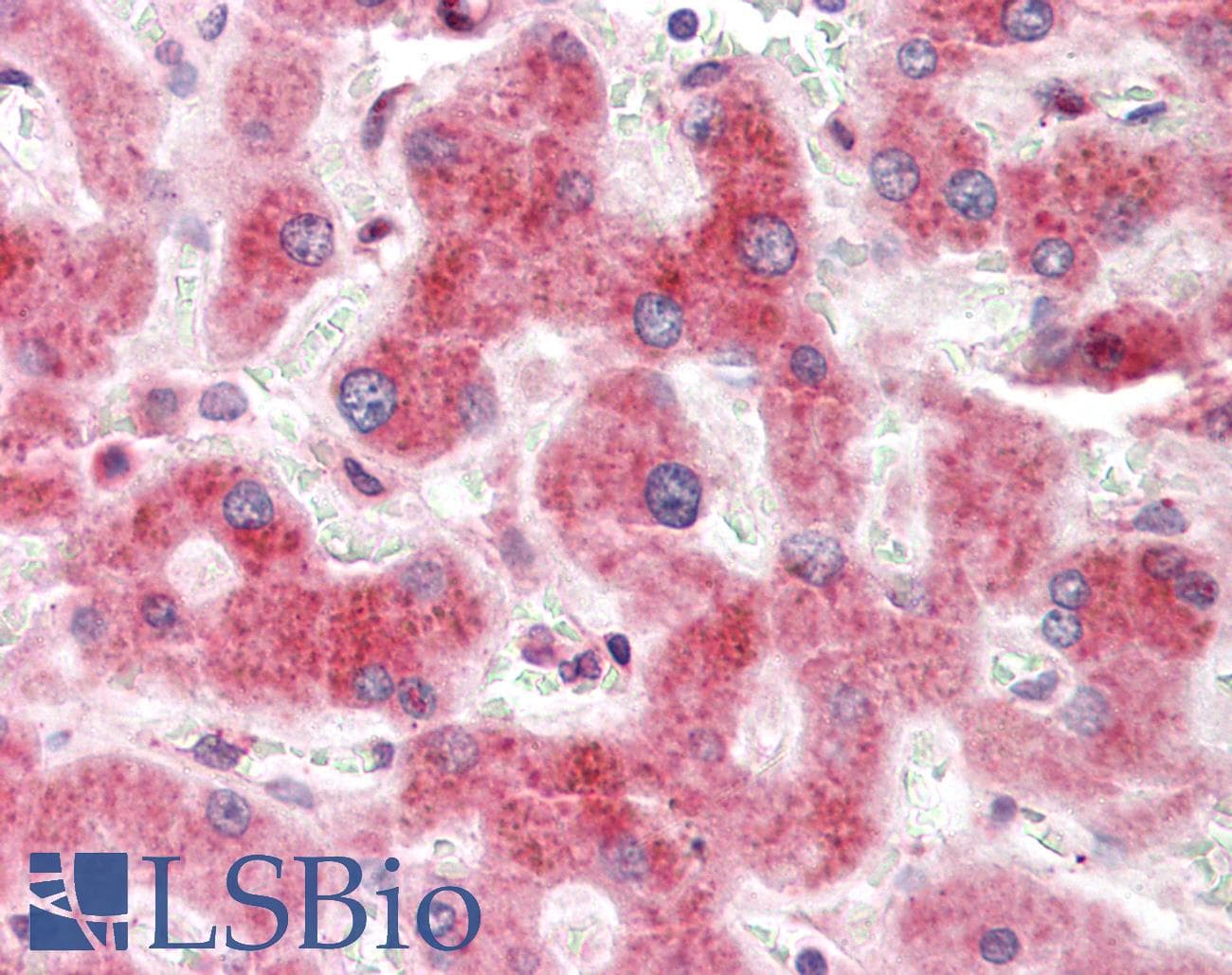 PRKCSH Antibody (aa155-204)