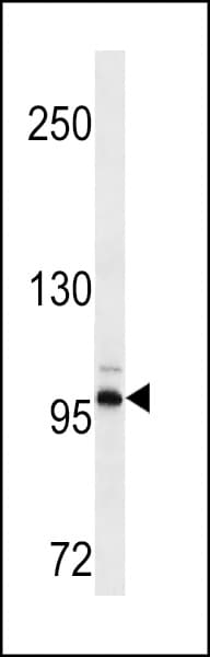 DDR2 Antibody (aa290-320)