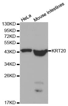 KRT20 / CK20 / Cytokeratin 20 Antibody