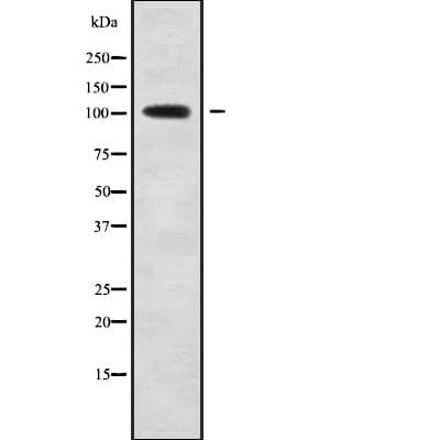 SLC8A1 / NCX1 Antibody