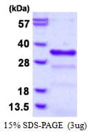 Human CHMP1B Protein (Recombinant His)