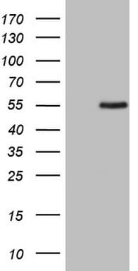 Monoclonal Mouse anti-Human ZNF200 Antibody (clone OTI3B6, WB)
