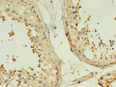 TMEM141 Antibody (aa1-108)