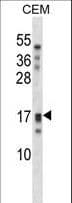 KLK15 / Kallikrein 15 Antibody (aa78-106)