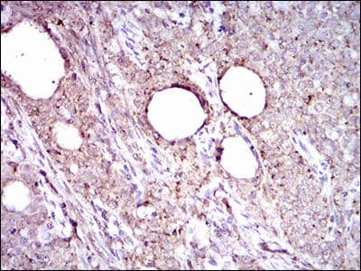Monoclonal Mouse anti-Human ALDH2 Antibody (clone 4G6A3, Amino Acid: 317-517, IHC, IF, WB)