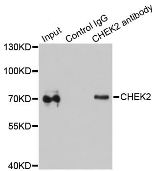 CHEK2 / CHK2 Antibody