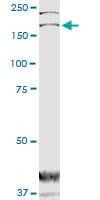 Monoclonal Mouse anti-Human DOCK180 / DOCK1 Antibody (clone 3D10, WB)