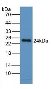 CCL2 / MCP1 Antibody