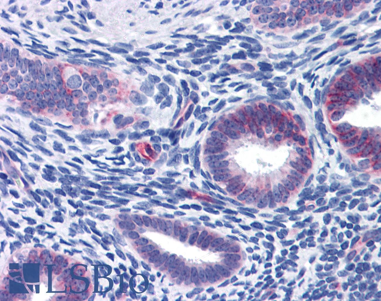 WDHD1 Antibody (aa611-660)