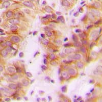RPL30 / Ribosomal Protein L30 Antibody (C-Terminus)