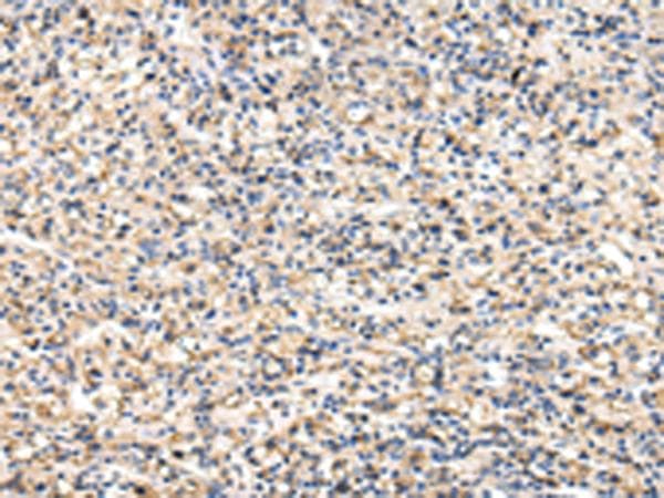VCAM1 / CD106 Antibody