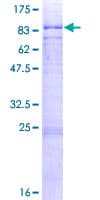 Human CDK17 / PCTK2 / PCTAIRE2 Protein (Recombinant GST)