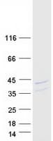 Human FBL / FIB / Fibrillarin Protein (Recombinant Myc-DDK (Flag))