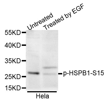 HSPB1 / HSP27 Antibody (phospho-Ser15)