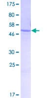 Human WBSCR27 Protein (Recombinant GST)