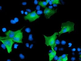 CCM2 / Malcavernin Antibody (clone OTI2C10)